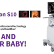 Advanced Ultrasound Machine for 4D Imaging Technology.